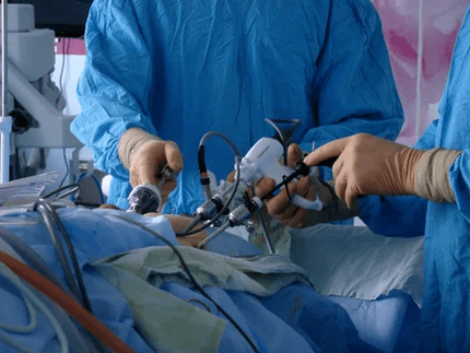 Χειρουργική παρέμβαση